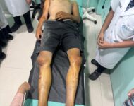 Curi Sepeda motor Dikejar Massa, Pelaku Tabrak Mobil