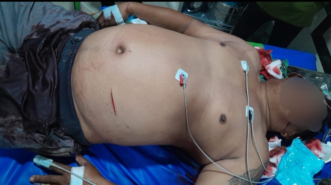 Akibat Sakit Hati, Pelaku Tikami Korban
