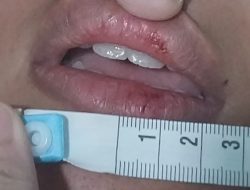 Diduga Aniaya Anak Tiri, Bripka R Ditahan Propam