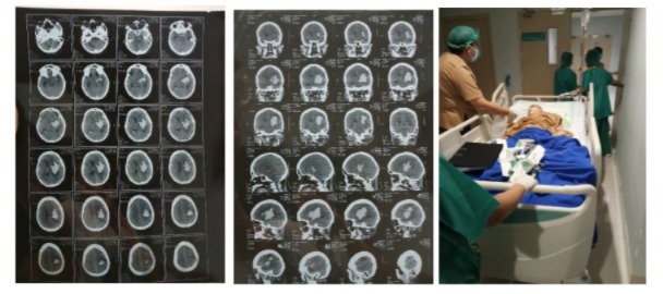 KRONOLOGI TERJADINYA DUGAAN MALAPRAKTEK VANNY FRANSIKA DI RS NURAIDA BOGOR