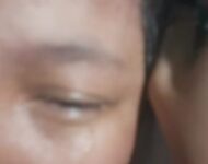 Pasutri, Anak dan Menantu Lempari Warga Hingga Luka Parah