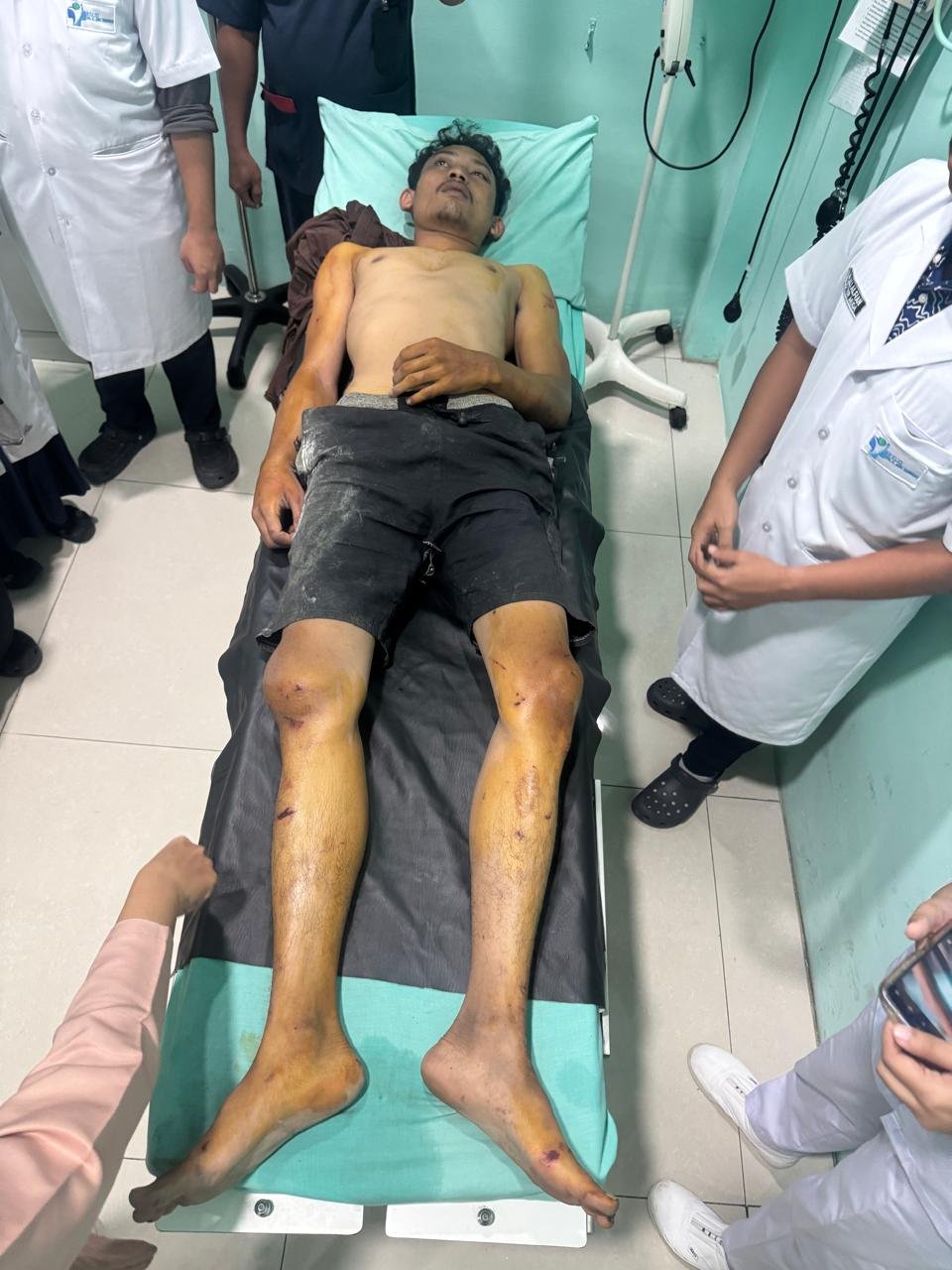 Curi Sepeda motor Dikejar Massa, Pelaku Tabrak Mobil Curi Sepeda motor Dikejar Massa, Pelaku Tabrak Mobil