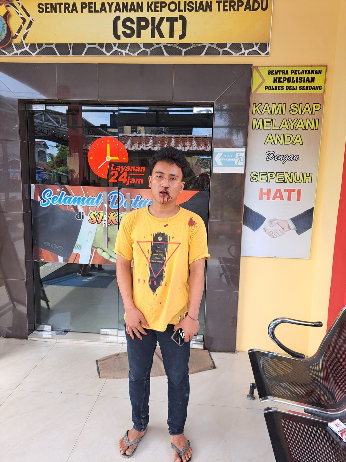 Anak Pedagang Sayur Tanjung Morawa Dipukuli OTK Anak Pedagang Sayur Tanjung Morawa Dipukuli OTK