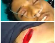 Preman Simpang Bacok Leher Dan Kepala Ridwan Hingga Robek