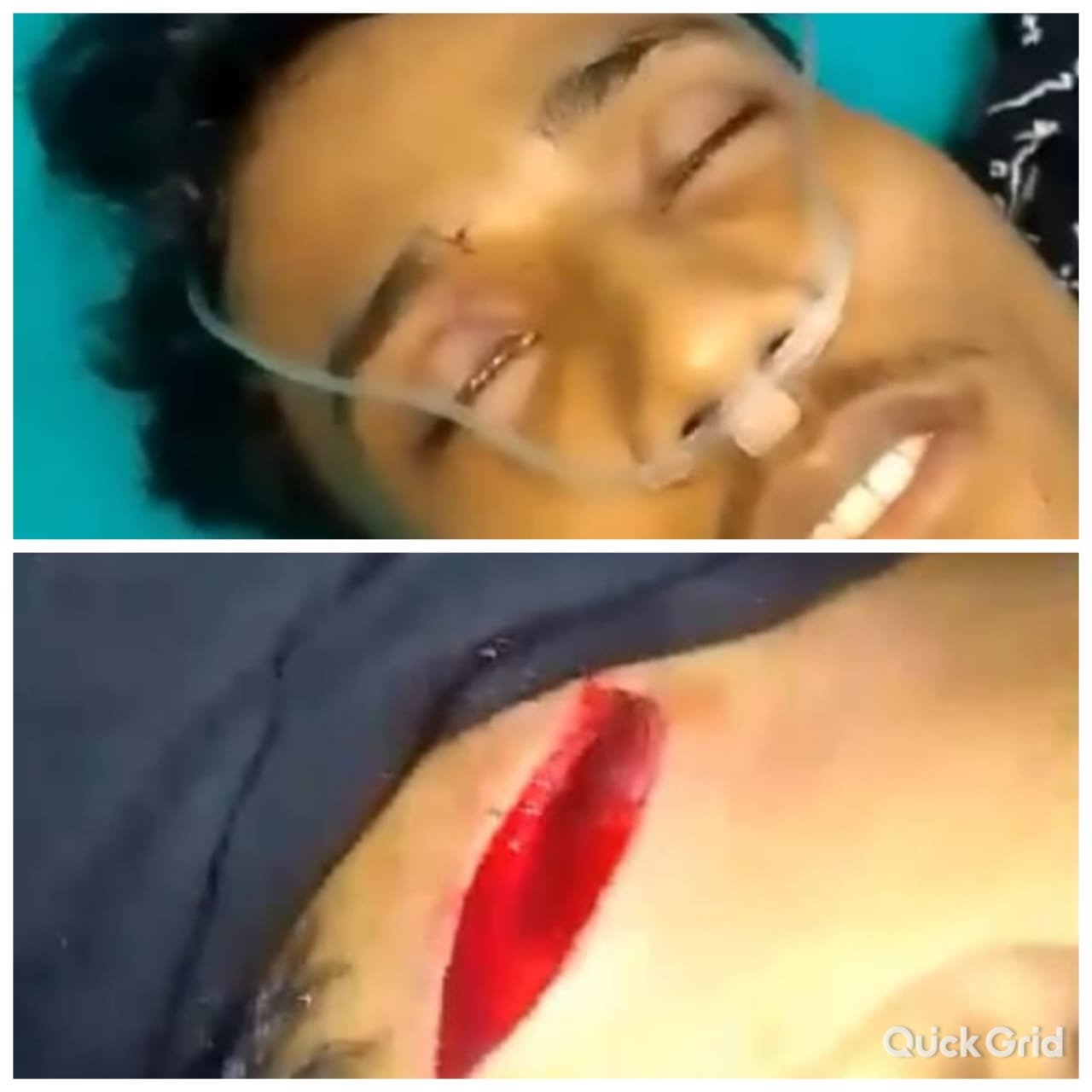 Preman Simpang Bacok Leher Dan Kepala Ridwan Hingga Robek Preman Simpang Bacok Leher Dan Kepala Ridwan Hingga Robek